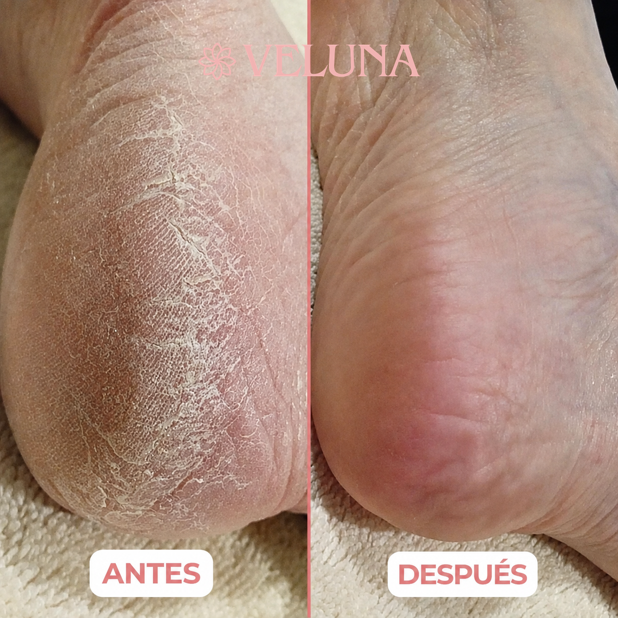 Antes y después en un talón seco