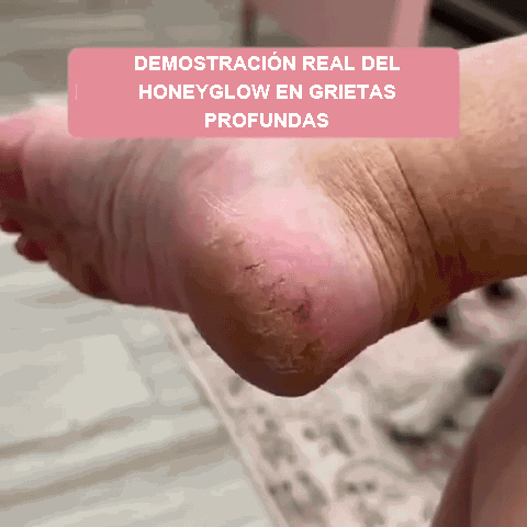 Demostración real del HoneyGlow en grietas profundas
