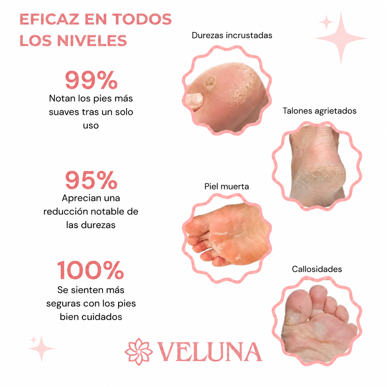 Eficaz en todos los niveles: durezas incrustadas, talones agrietados, piel muerta y callosidades