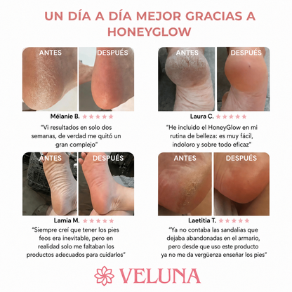 Resultados antes y despues de cuatro clientas tras usar HoneyGlow de Veluna